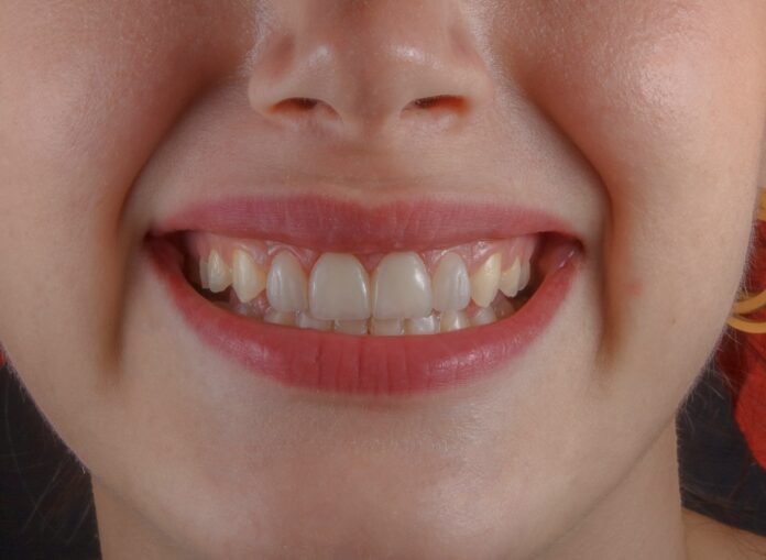 Tooth Sensitivity After Age 50